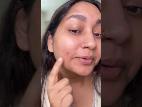 cover of next post